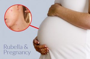 How Can My Rubella Infection Be Treated Best Fertility Specialist Delhi   Rubella Infection Pregnancy 